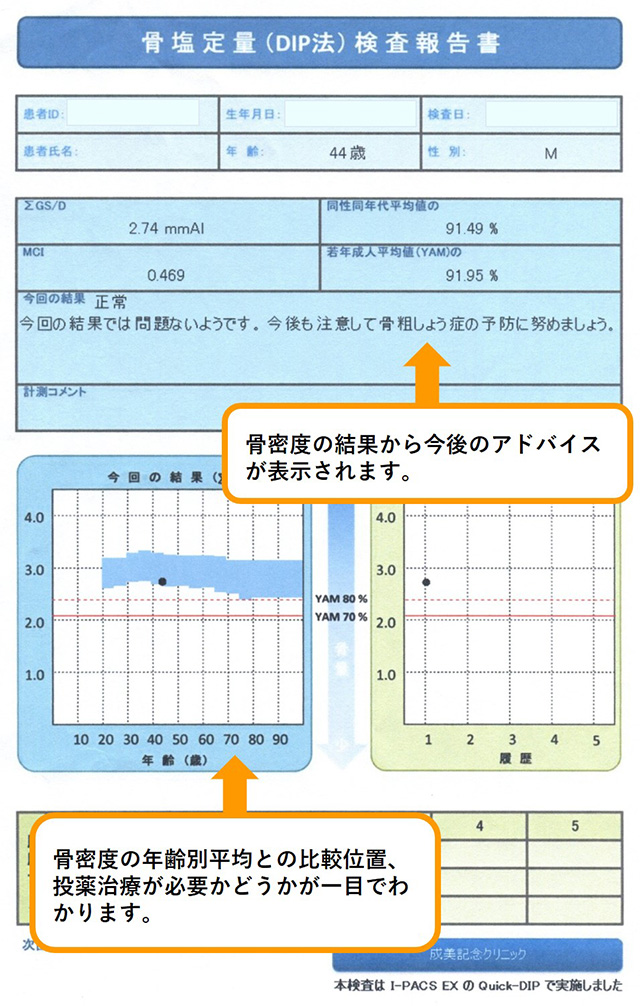 骨密度検査